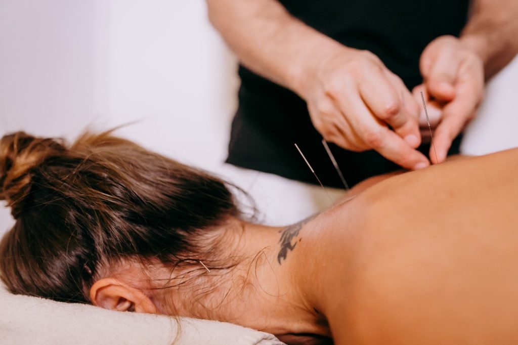 The Power of Acupuncture in Boosting Fertility