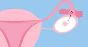 Coping with Ovulation: Tips for Managing Mood Swings and Discomfort