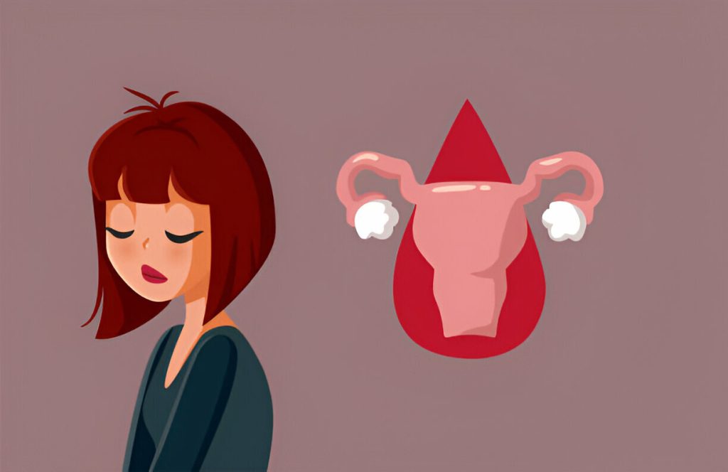oligomenorrhea