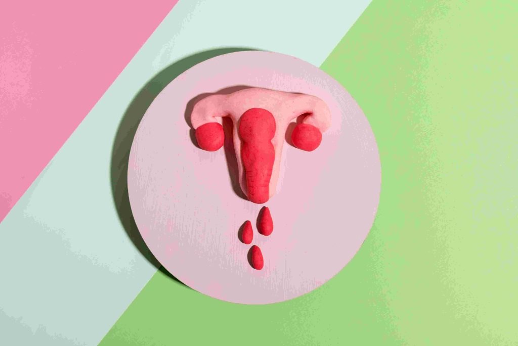 Menorrhagia